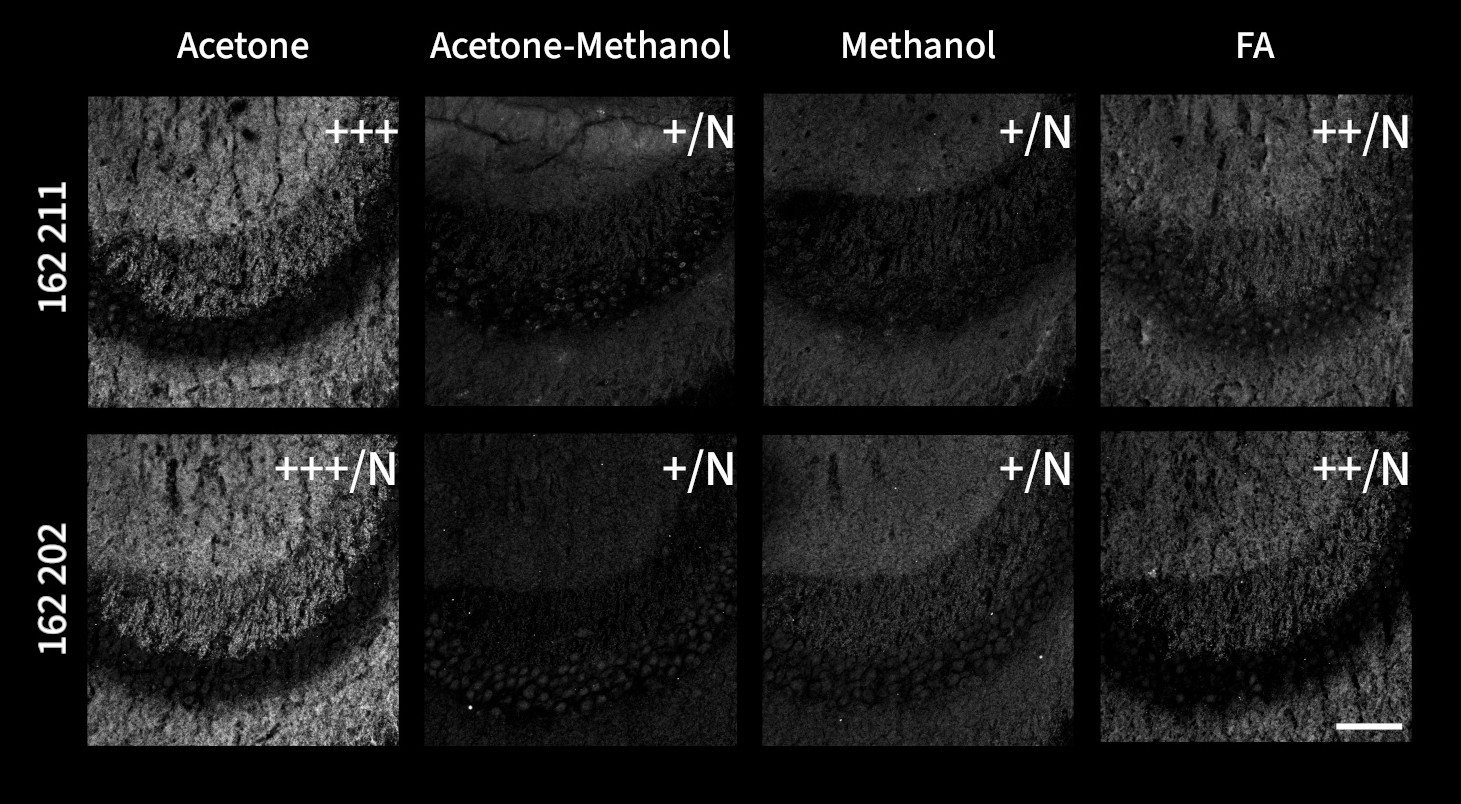 Microscopy images illustrate the effects of acetone, acetone-methanol (1:1), methanol, and 4% FA fixation on indirect immunostaining of fresh frozen mouse hippocampus sections with Shank2 antibodies (1:500, greyscale).
