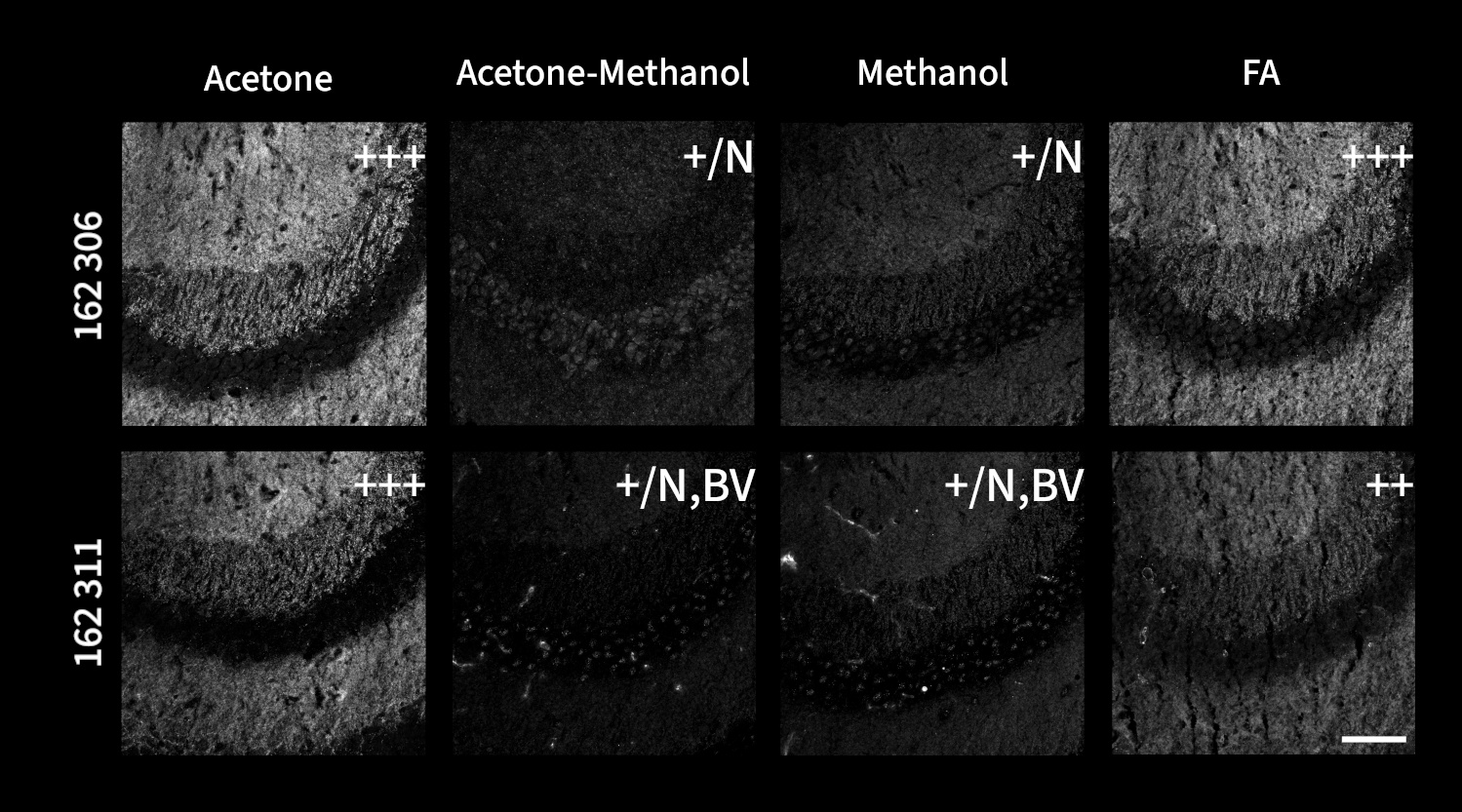 Microscopy images illustrate the effects of acetone, acetone-methanol (1:1), methanol, and 4% FA fixation on indirect immunostaining of fresh frozen mouse hippocampus sections with Shank3 antibodies (1:500, greyscale).