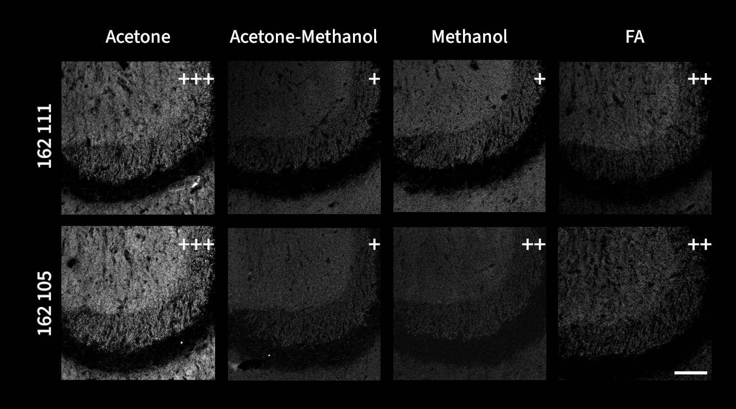 Microscopy images illustrate the effects of acetone, acetone-methanol (1:1), methanol, and 4% FA fixation on indirect immunostaining of fresh frozen mouse hippocampus sections with antibodies targeting Shank1, Shank2 and Shank3 proteins jointly
