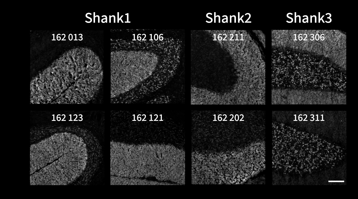 Microscopy images showing the comparison of Shank1, Shank2 and Shank3 antibodies’ specificity and cross-reactivity using indirect immunostaining of fresh frozen mouse cerebellum sections post-fixed with acetone.