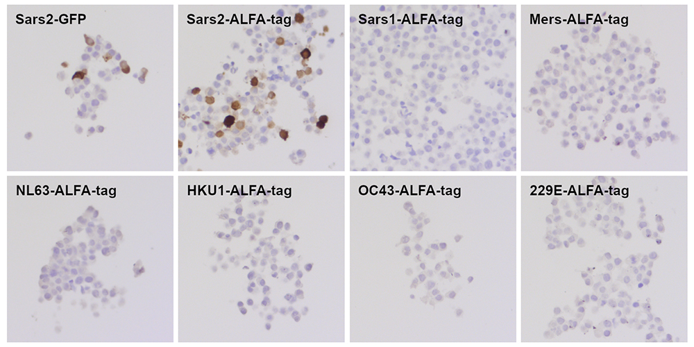 Indirect immunostaining of formalin fixed paraffin embedded (FFPE) HEK cells transfected with mammalian expression plasmids coding for full-length ALFA- or GFP tagged nucleocapsid proteins of diverse coronavirus strains using the monoclonal anti-SARS-CoV-2 nucleocapsid antibody clone #4A8