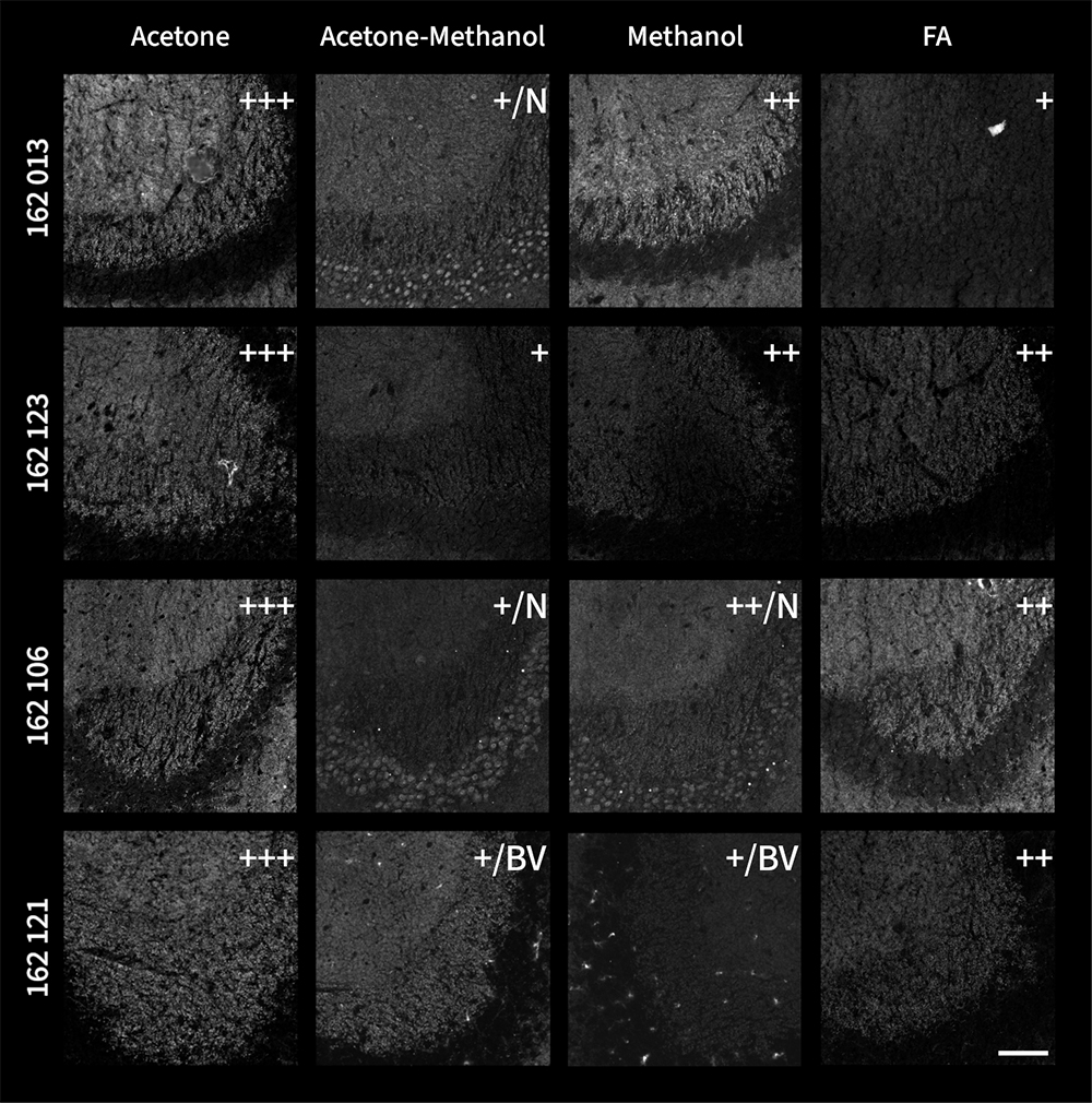 Microscopy images illustrate the effects of acetone, acetone-methanol (1:1), methanol, and 4% FA fixation on indirect immunostaining of fresh frozen mouse hippocampus sections with different Shank1 antibodies (1:500, greyscale).