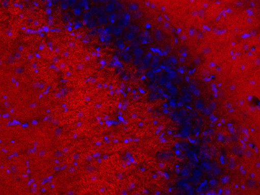 Indirect immunostaining of free floating PFA-fixed rat hippocampus