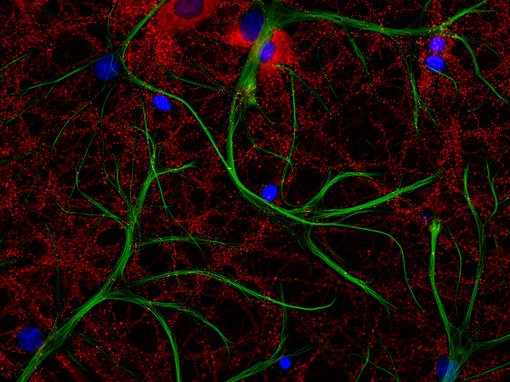 Indirect immunostaining of PFA-fixed rat hippocampus neurons