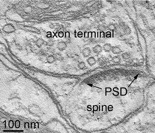 EM tomography of a rat hippocampus synapse