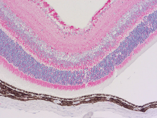 Indirect immunostaining of PFA fixed paraffin embedded mouse eye section with mouse anti-α-tubulin 