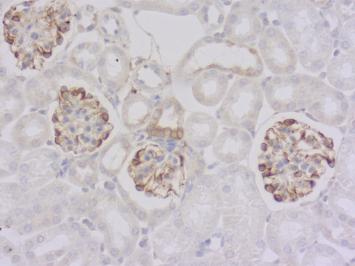 Figure 3b: mouse anti-Glu-α-Tubulin (cat. no. 302 011, dilution 1 : 1000; DAB). Nuclei have been visualized by haematoxylin staining (blue).