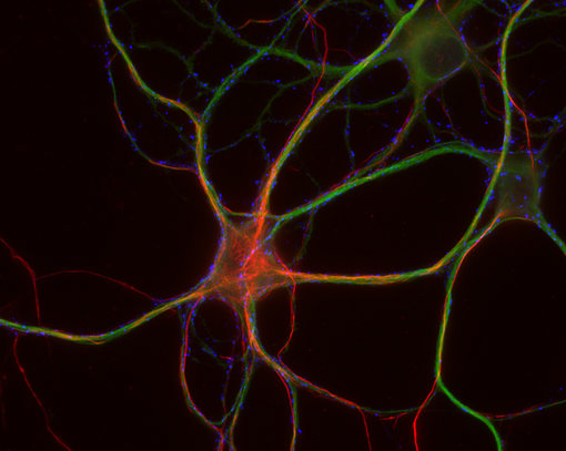 Indirect immunostaining of PFA fixed rat hippocampus neurons with rabbit anti-Neurofilament H