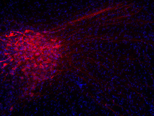 Indirect immunostaining of PFA fixed rat hypothalamus section with guinea pig anti-Vasopressin antibody