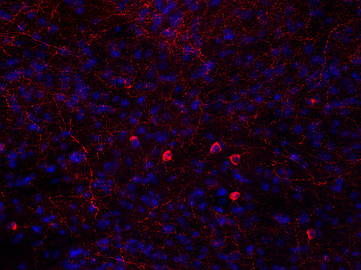Indirect immunostaining of PFA fixed mouse striatum section with chicken anti-Neuropeptide Y antibody