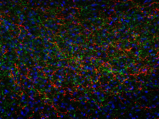 Indirect immunostaining of PFA fixed rat hypothalamus section with guinea pig anti-ACTH antibody