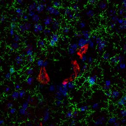 Indirect immunostaining of a formaldehyde fixed mouse cortex section with mouse anti-P2Y12 antibody