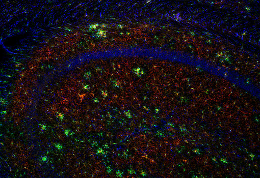 Indirect immunostaining of a formaldehyde fixed mouse hippocampus section of an APP/PS1 mouse with guinea pig anti-P2Y12 antibody