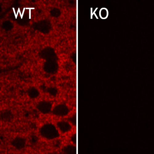 Indirect immuno-staining of EAAT2 in the neocortex of heterozygote (+/-) and knockout (-/-) mice