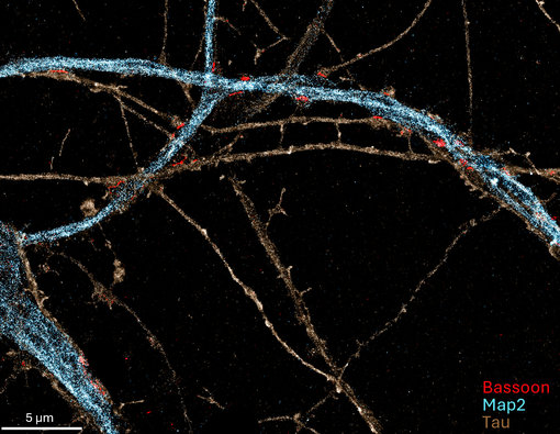 Multiplex staining of formaldehyde fixed rat hippocampus neurons. Blue, red and green neuron strings are clearly visible.